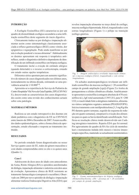 esofagite eosinofílica - Acta Médica Portuguesa