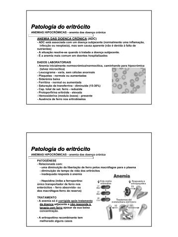 Patologia do eritrócito Patologia do eritrócito