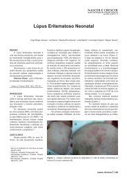 Lúpus Eritematoso Neonatal
