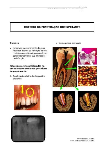 Penetração Desinfetante - Endoatlas.com.br