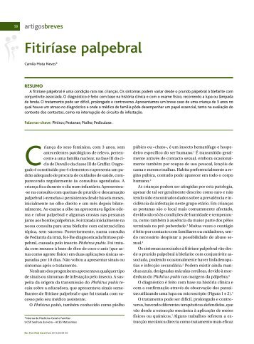 Fitiríase palpebral - Associação Portuguesa de Medicina Geral e ...