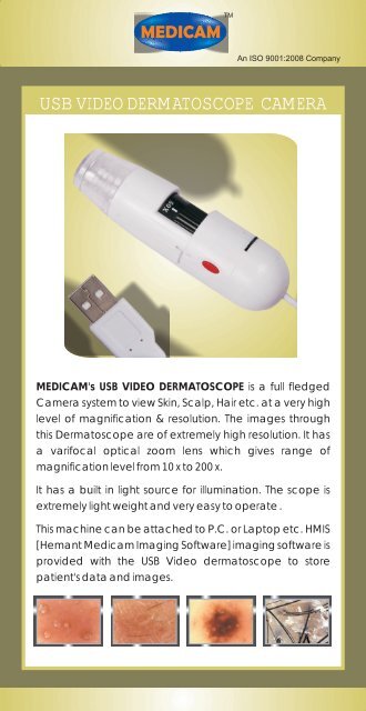 USB video dermatoscope - medicam