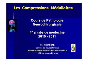 Les Compressions Médullaires Lentes