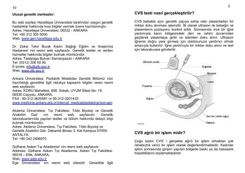 Koryonik Villus Biyopsi (CVS) Testi - EuroGentest