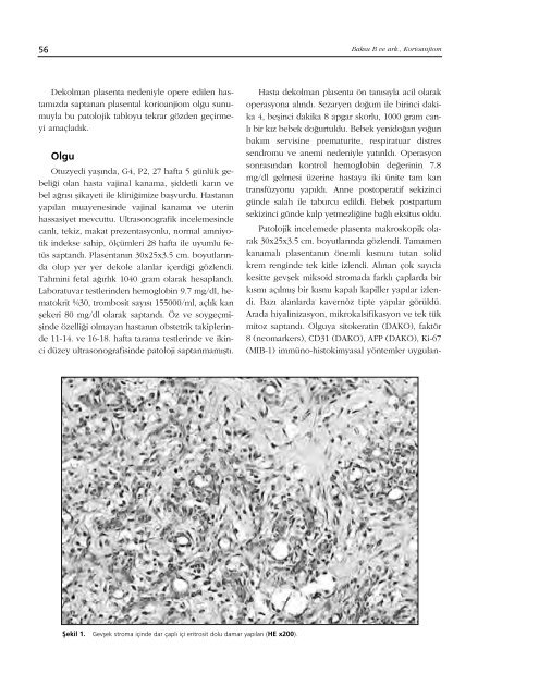 Adobe Pdf - Perinatoloji Dergisi