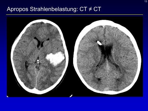 Neuroradiologie für Kinderärzte: CT und MRT