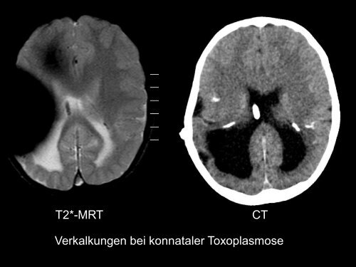 Neuroradiologie für Kinderärzte: CT und MRT