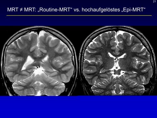 Neuroradiologie für Kinderärzte: CT und MRT
