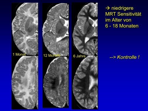 Neuroradiologie für Kinderärzte: CT und MRT