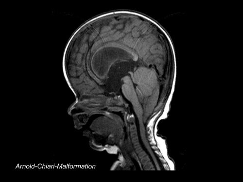 Neuroradiologie für Kinderärzte: CT und MRT