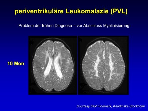 Neuroradiologie für Kinderärzte: CT und MRT