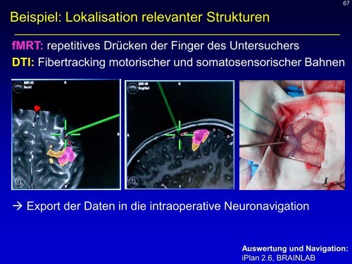 Neuroradiologie für Kinderärzte: CT und MRT