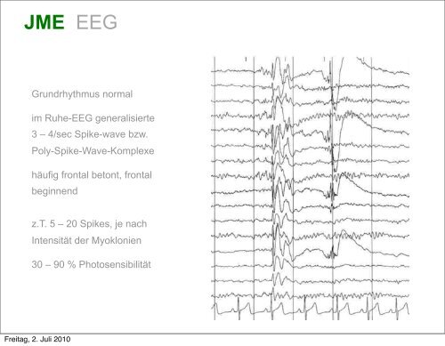 Heinen Epileptologie WS 09-10.pdf - 3,76 Mb