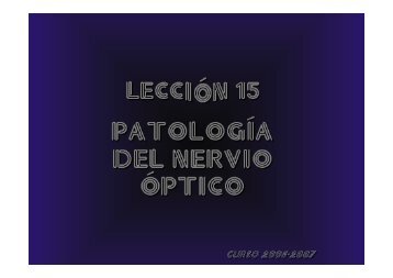 neuropatía óptica