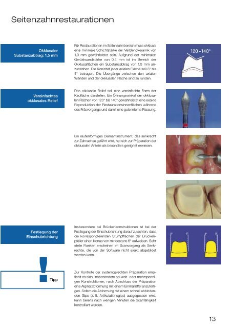 Cercon - Klinischer Leitfaden - Dental-Labor Hans Fuhr GmbH & Co ...