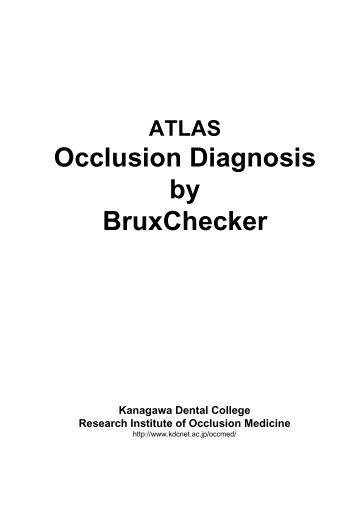 Atlas occlusion diagnosis by bruxchecker