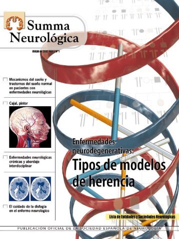 Enfermedades Neurodegenerativas: Tipos de ... - Ibañez y Plaza