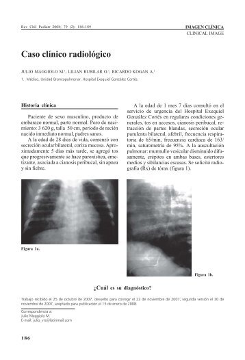 Caso clínico radiológico - SciELO