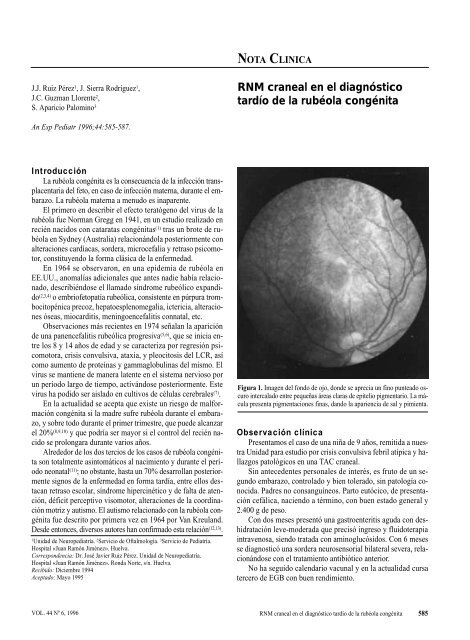 RNM craneal en el diagnóstico tardío de la - Asociación Española ...