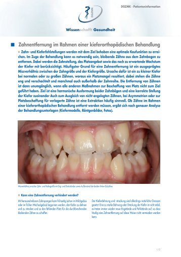 pdf-Download - Deutsche Gesellschaft für Zahn-, Mund- und ...
