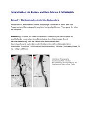 Rekanalisation von Becken- und Bein-Arterien, 6 Fallbeispiele
