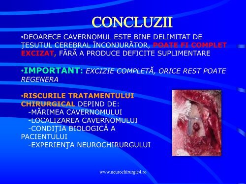 Actualitati in managementul cavernoamelor cerebrale