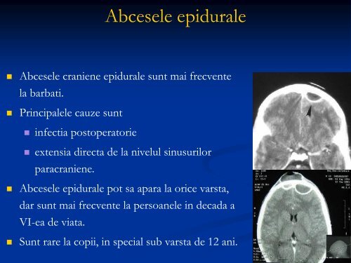 Plagi cranio-cerebrale infectate. Osteomielita voletului. Empiemul ...