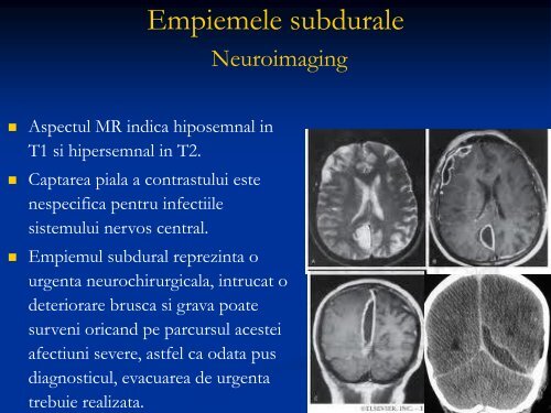 Plagi cranio-cerebrale infectate. Osteomielita voletului. Empiemul ...