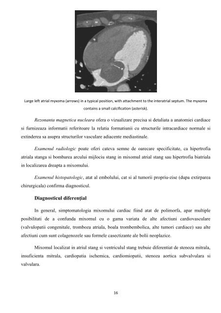 Tumorile cardiopericardice Prof Dr Grigore Tinica, Dr. Lutea Mirela ...