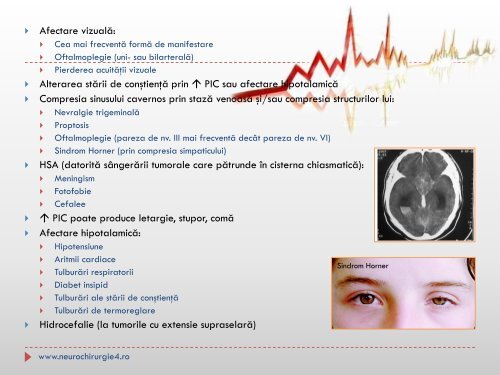 ADENOMUL HIPOFIZAR – NEUROIMAGERIE, DATE CLINICE