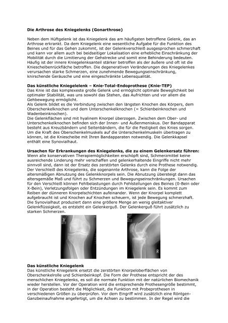 Knieprothese - Dominikus Krankenhaus Düsseldorf Heerdt GmbH