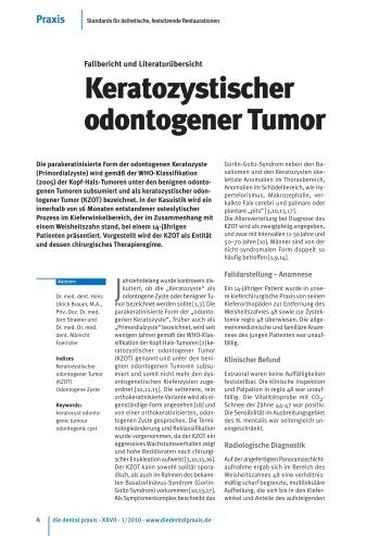 VerÃ¶ffentlichung Keratozystischer odontogener Tumor