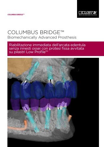 COLUMBUS BRIDGE™ - Biomax