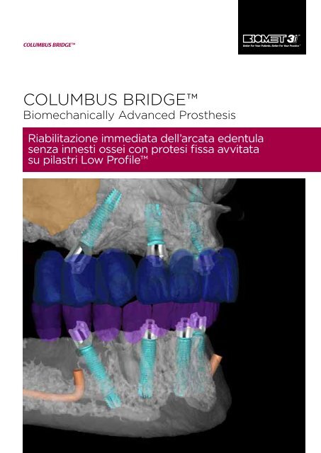 COLUMBUS BRIDGE™ - Biomax