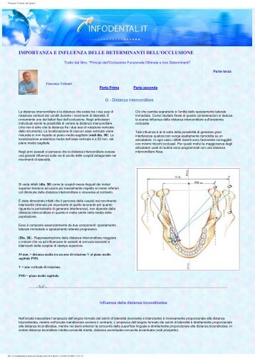 Vincenzo Volontè Art2-parte3 - Infodental