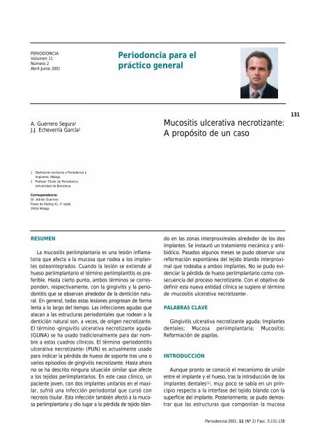 Mucositis ulcerativa necrotizante: A propósito de un caso ... - SEPA