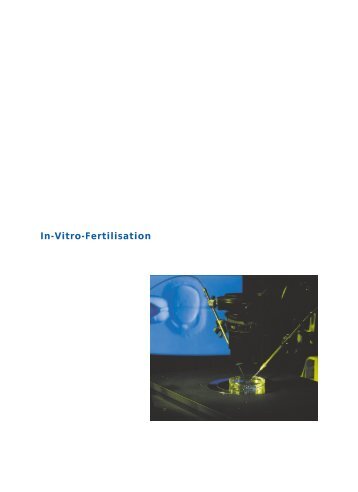 Die Behandlung: In-Vitro-Fertilisation - Dr. med. Peter Fehr