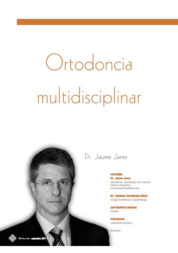 Tratamiento Multidisciplinar (TMD) de una ... - Janer Ortodoncia