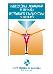 Histeroscòpia laparoscòpica - Hospital de Barcelona