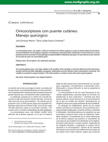 Onicocriptosis con puente cutáneo. Manejo ... - edigraphic.com