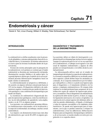 Endometriosis y cáncer