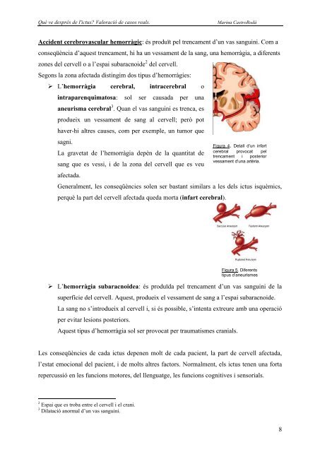 Accident Cerebrovascular (ACV) o Ictus - IES Narcís Monturiol