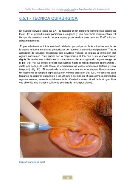 Fiabilidad de los predictores clínicos y de la biopsia de arteria ...