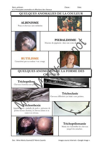 Anomalies de la couleur des cheveux - Académie d'Aix-Marseille