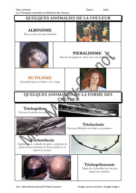 Anomalies De La Couleur Des Cheveux Academie D Aix Marseille Anomalies De La Couleur Des Cheveux Academie D Aix Marseille