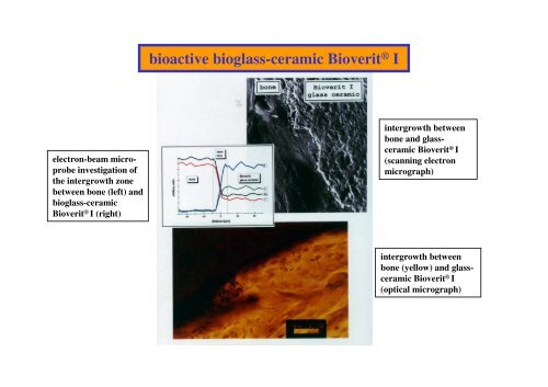 Bioceramics-Dr. Carls 2 - G.-Wiehebrink