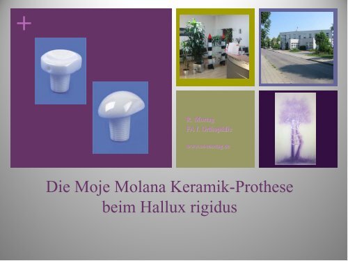 Die Moje Molana Keramik-Prothese beim Hallux ... - G.-Wiehebrink