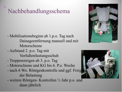 Die Moje Molana Keramik-Prothese beim Hallux ... - G.-Wiehebrink