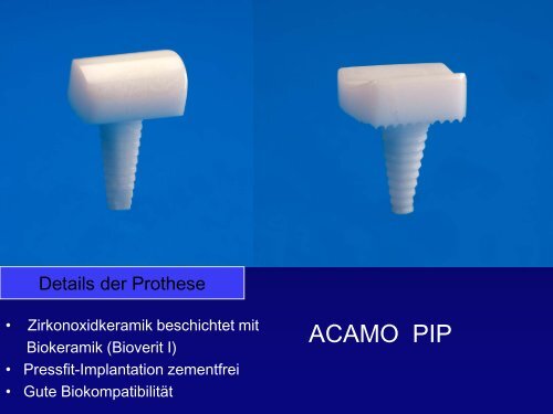 ACAMO-Fingermittelgelenk - G.-Wiehebrink