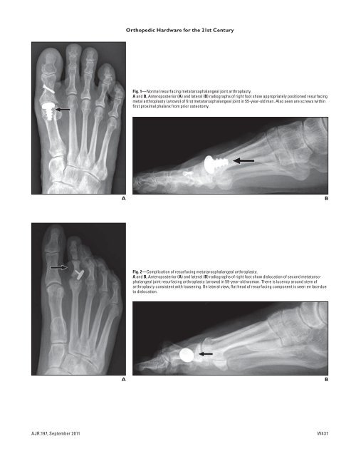 New and Improved Orthopedic Hardware for the 21st Century: Part 2 ...